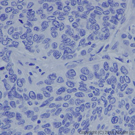 Immunohistochemistry (Formalin/PFA-fixed paraffin-embedded sections) - Anti-MASH1/Achaete-scute homolog 1 antibody [EPR19592] (AB213151)