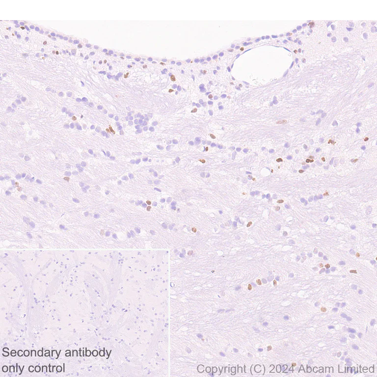 Immunohistochemistry (Formalin/PFA-fixed paraffin-embedded sections) - Anti-MASH1/Achaete-scute homolog 1 antibody [EPR19592] (AB213151)