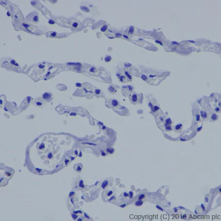 Immunohistochemistry (Formalin/PFA-fixed paraffin-embedded sections) - Anti-MASH1/Achaete-scute homolog 1 antibody [EPR19592] (AB213151)