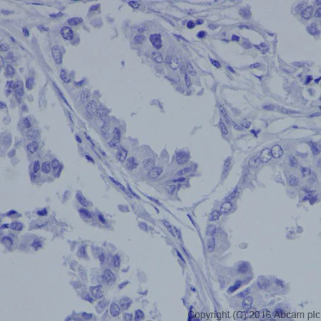 Immunohistochemistry (Formalin/PFA-fixed paraffin-embedded sections) - Anti-MASH1/Achaete-scute homolog 1 antibody [EPR19592] (AB213151)