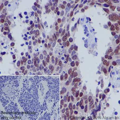 Immunohistochemistry (Formalin/PFA-fixed paraffin-embedded sections) - Anti-MASH1/Achaete-scute homolog 1 antibody [EPR19592] - BSA and Azide free (AB251539)