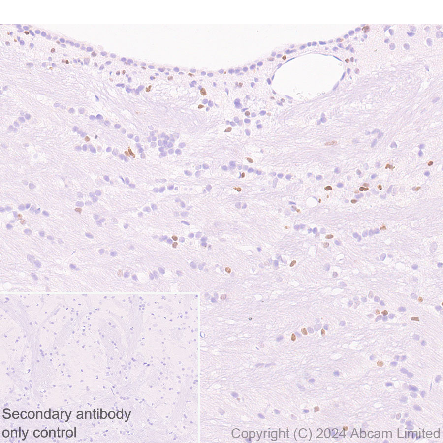 Immunohistochemistry (Formalin/PFA-fixed paraffin-embedded sections) - Anti-MASH1/Achaete-scute homolog 1 antibody [EPR19592] - BSA and Azide free (ab251539), expandable thumbnail