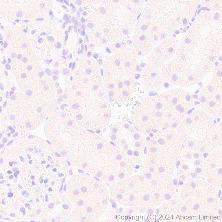 Immunohistochemistry (Formalin/PFA-fixed paraffin-embedded sections) - Anti-MASH1/Achaete-scute homolog 1 antibody [EPR19592] - BSA and Azide free (AB251539)