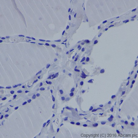 Immunohistochemistry (Formalin/PFA-fixed paraffin-embedded sections) - Anti-MASH1/Achaete-scute homolog 1 antibody [EPR19592] - BSA and Azide free (AB251539), expandable thumbnail