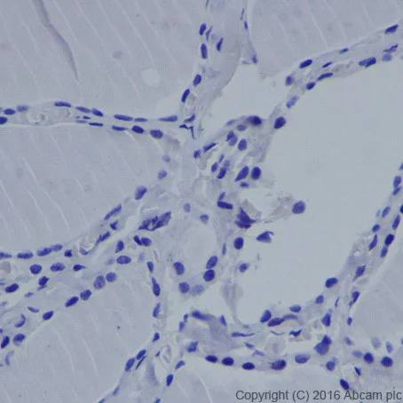 Immunohistochemistry (Formalin/PFA-fixed paraffin-embedded sections) - Anti-MASH1/Achaete-scute homolog 1 antibody [EPR19592] - BSA and Azide free (AB251539)