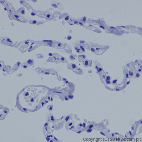 Immunohistochemistry (Formalin/PFA-fixed paraffin-embedded sections) - Anti-MASH1/Achaete-scute homolog 1 antibody [EPR19592] - BSA and Azide free (AB251539), expandable thumbnail