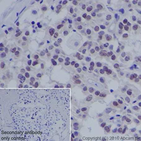 Immunohistochemistry (Formalin/PFA-fixed paraffin-embedded sections) - Anti-MASH1/Achaete-scute homolog 1 antibody [EPR19592] - BSA and Azide free (AB251539)