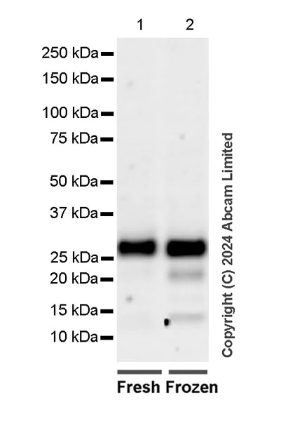 Western blot - Anti-MASH1/Achaete-scute homolog 1 antibody [EPR19592] - BSA and Azide free (AB251539)