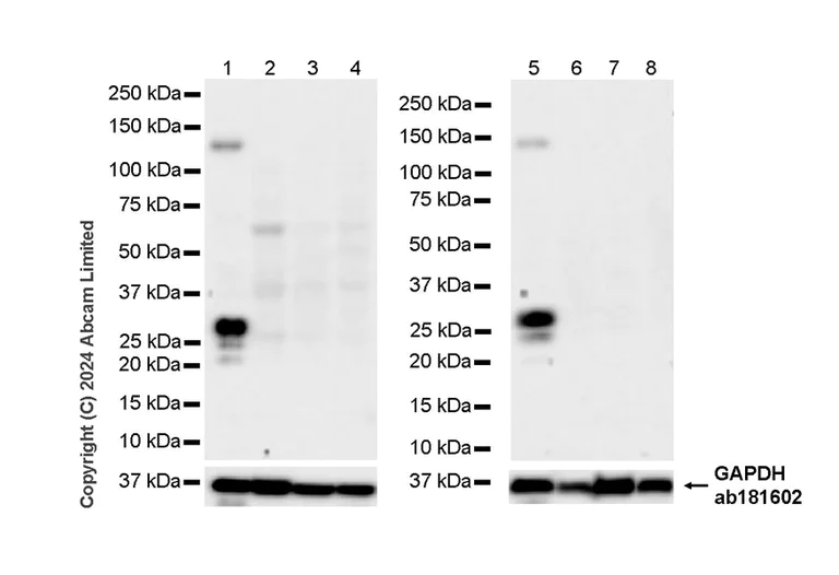 Western blot - Anti-MASH1/Achaete-scute homolog 1 antibody [EPR19592] - BSA and Azide free (AB251539)
