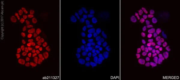 Immunocytochemistry/ Immunofluorescence - Anti-MASH1/Achaete-scute homolog 1 antibody [EPR19840] (AB211327)