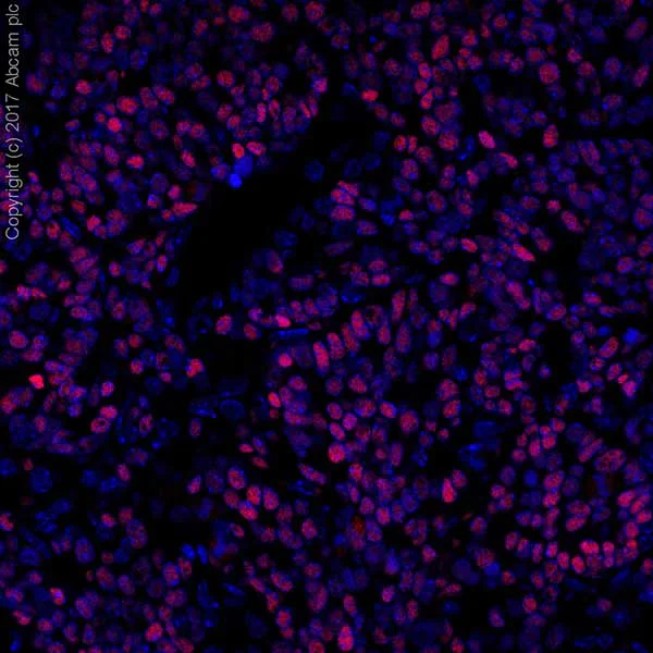 Immunohistochemistry (Formalin/PFA-fixed paraffin-embedded sections) - Anti-MASH1/Achaete-scute homolog 1 antibody [EPR19840] (AB211327)