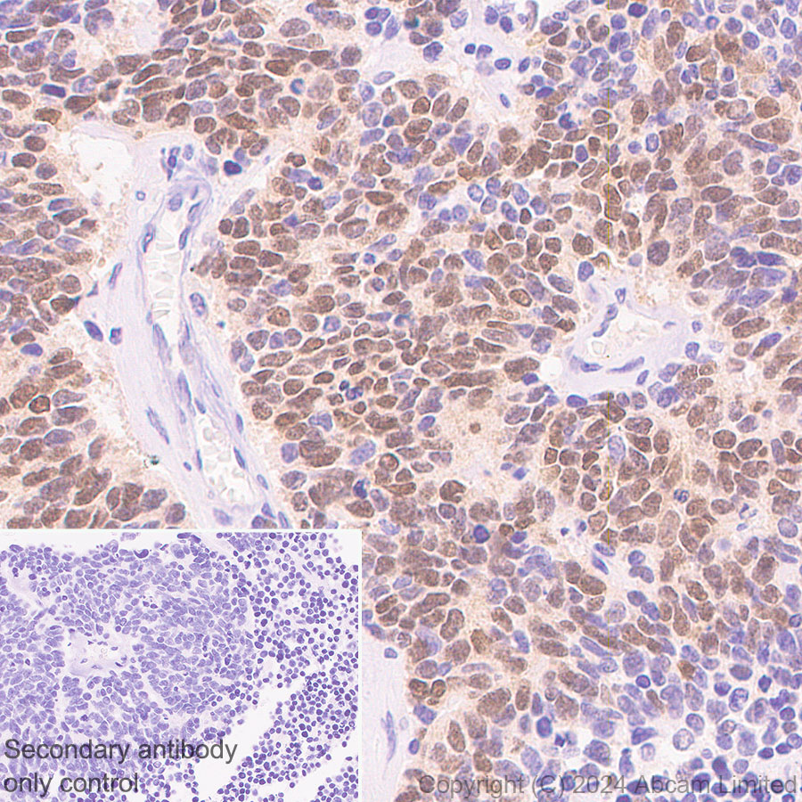 Immunohistochemistry (Formalin/PFA-fixed paraffin-embedded sections) - Anti-MASH1/Achaete-scute homolog 1 antibody [EPR19840] (ab211327), expandable thumbnail