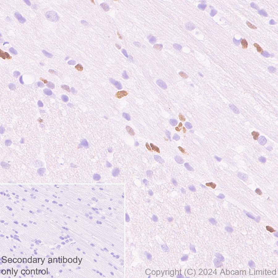 Immunohistochemistry (Formalin/PFA-fixed paraffin-embedded sections) - Anti-MASH1/Achaete-scute homolog 1 antibody [EPR19840] (ab211327), expandable thumbnail