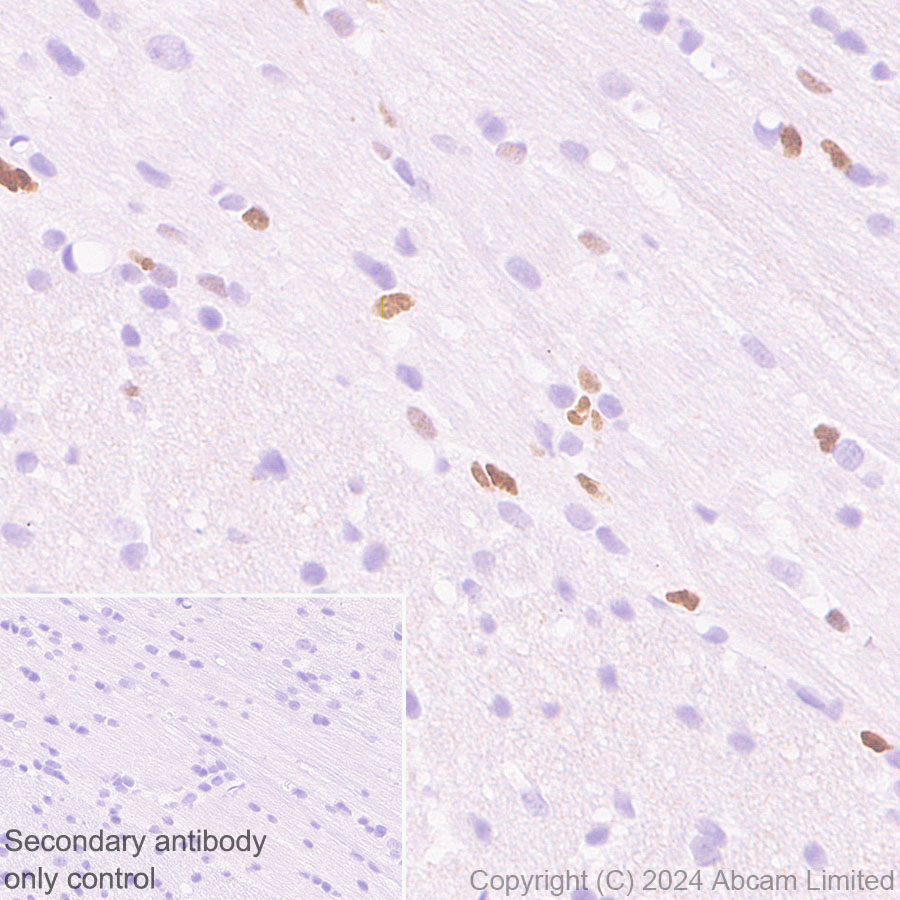 Immunohistochemistry (Formalin/PFA-fixed paraffin-embedded sections) - Anti-MASH1/Achaete-scute homolog 1 antibody [EPR19840] (ab211327), expandable thumbnail