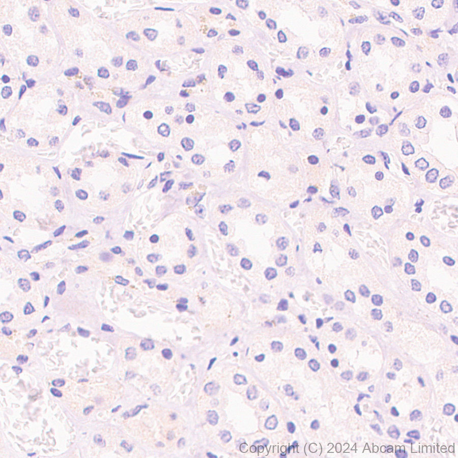 Immunohistochemistry (Formalin/PFA-fixed paraffin-embedded sections) - Anti-MASH1/Achaete-scute homolog 1 antibody [EPR19840] (ab211327), expandable thumbnail