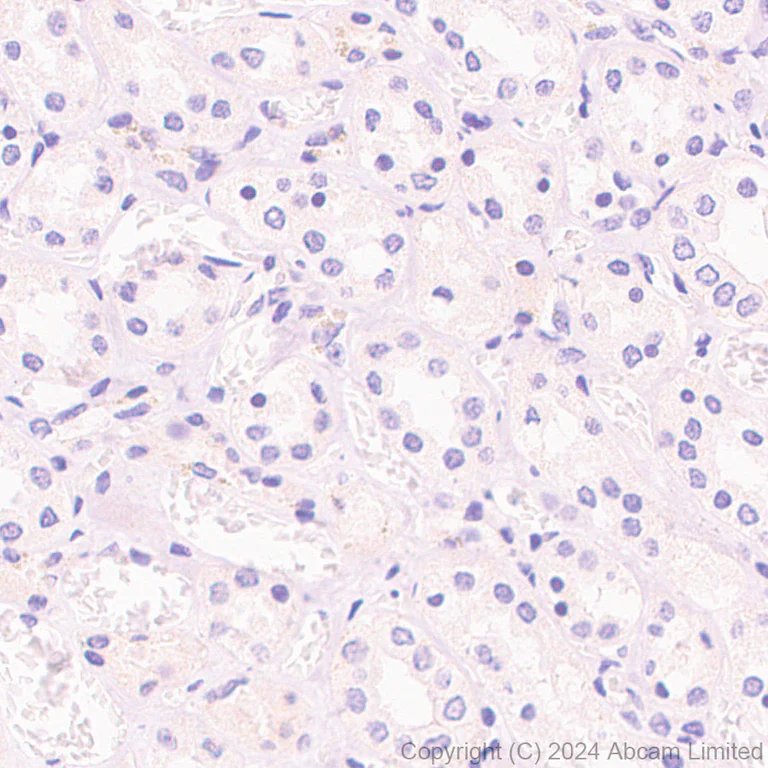 Immunohistochemistry (Formalin/PFA-fixed paraffin-embedded sections) - Anti-MASH1/Achaete-scute homolog 1 antibody [EPR19840] (AB211327)