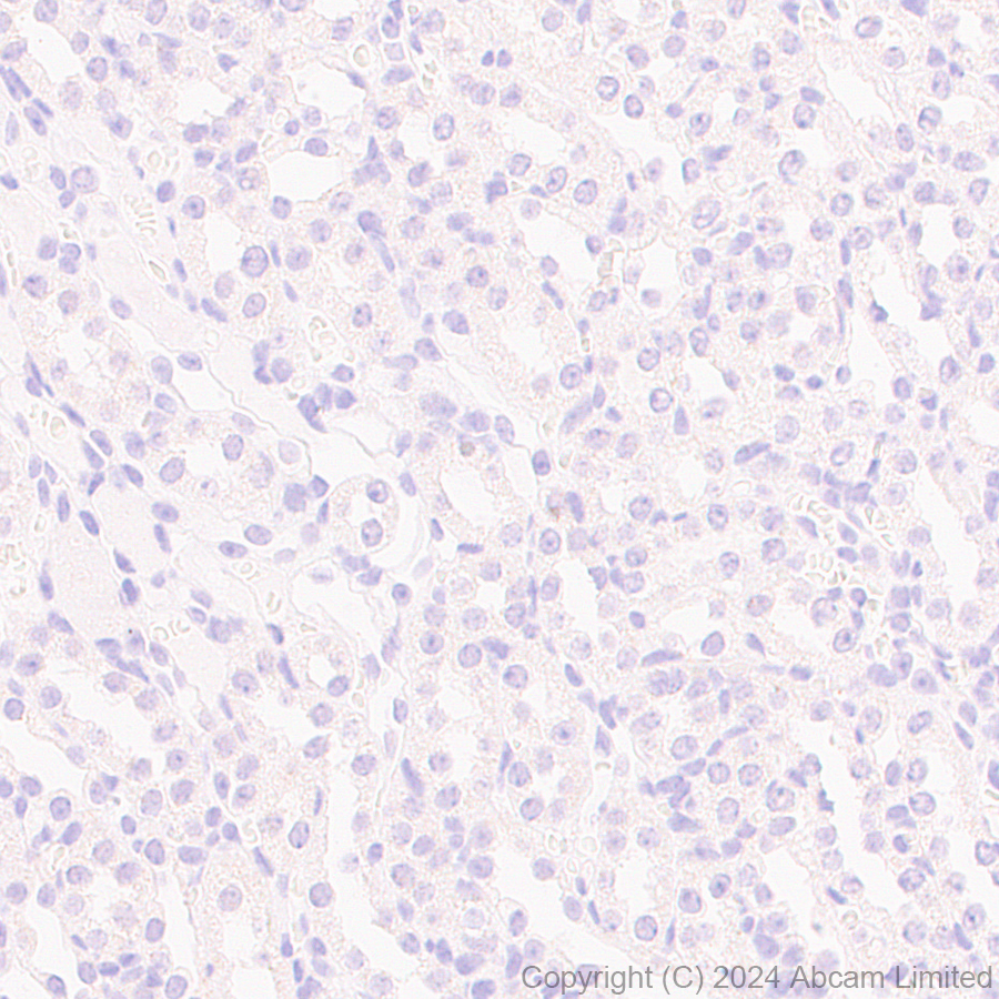 Immunohistochemistry (Formalin/PFA-fixed paraffin-embedded sections) - Anti-MASH1/Achaete-scute homolog 1 antibody [EPR19840] (ab211327), expandable thumbnail