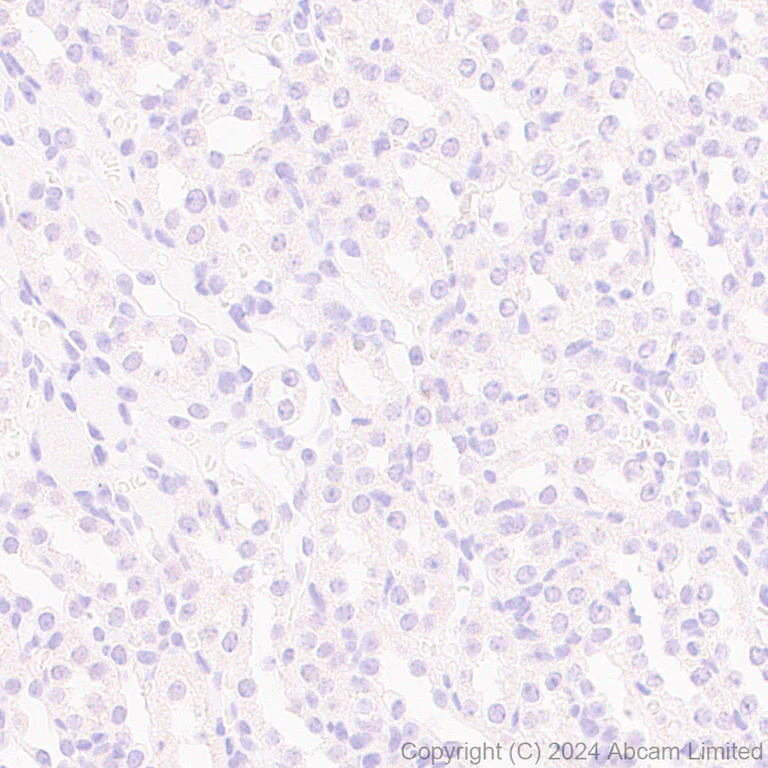 Immunohistochemistry (Formalin/PFA-fixed paraffin-embedded sections) - Anti-MASH1/Achaete-scute homolog 1 antibody [EPR19840] (AB211327)