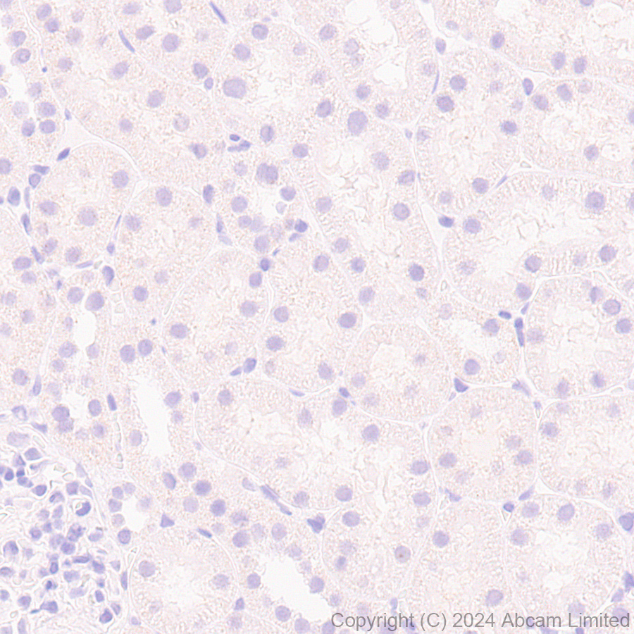 Immunohistochemistry (Formalin/PFA-fixed paraffin-embedded sections) - Anti-MASH1/Achaete-scute homolog 1 antibody [EPR19840] (ab211327), expandable thumbnail