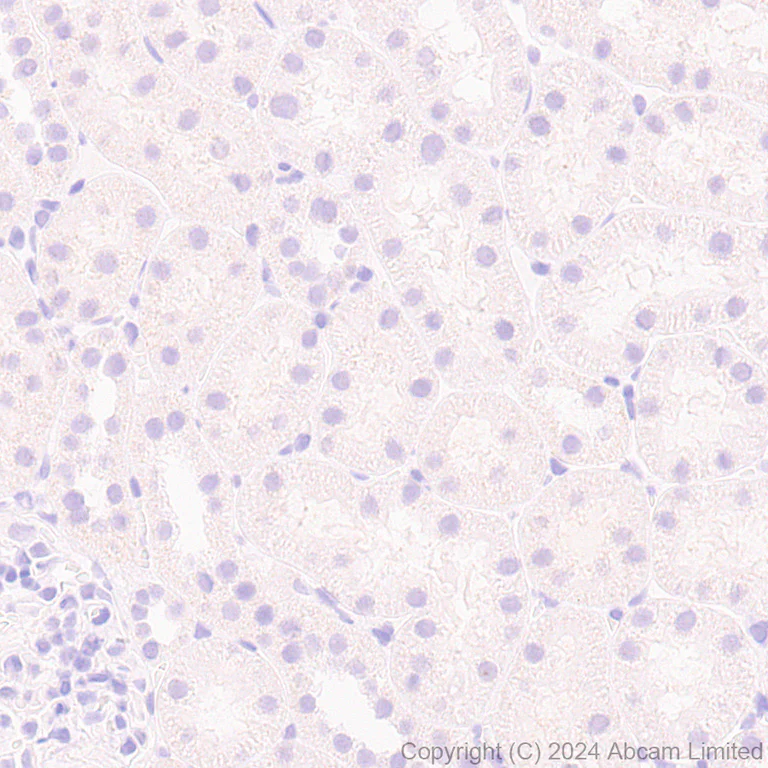 Immunohistochemistry (Formalin/PFA-fixed paraffin-embedded sections) - Anti-MASH1/Achaete-scute homolog 1 antibody [EPR19840] (AB211327)