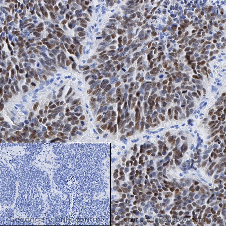Anti-MASH1/Achaete-scute homolog 1 antibody [EPR19840