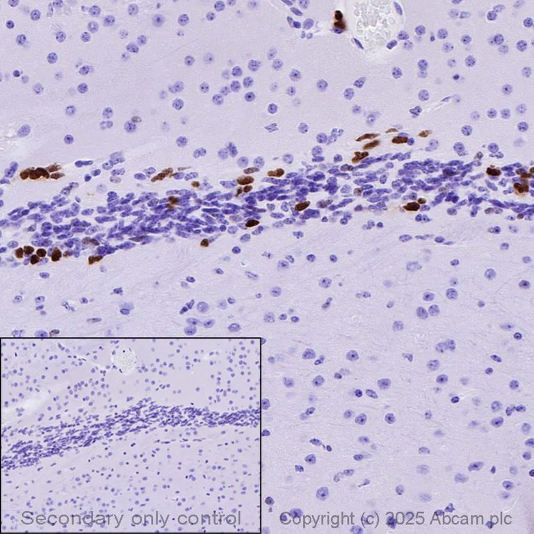 Anti-MASH1/Achaete-scute homolog 1 antibody [EPR19840