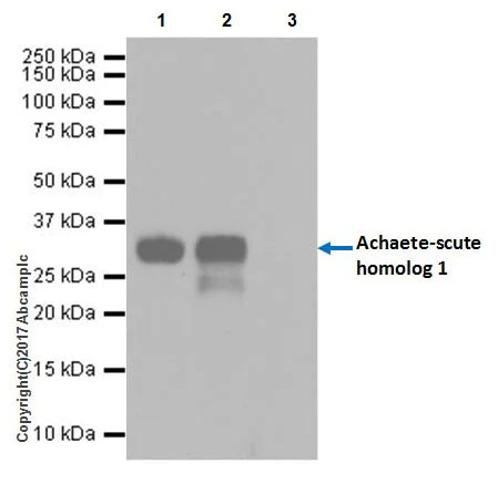 Immunoprecipitation - Anti-MASH1/Achaete-scute homolog 1 antibody [EPR19840] (AB211327)