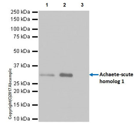 Immunoprecipitation - Anti-MASH1/Achaete-scute homolog 1 antibody [EPR19840] (AB211327), expandable thumbnail