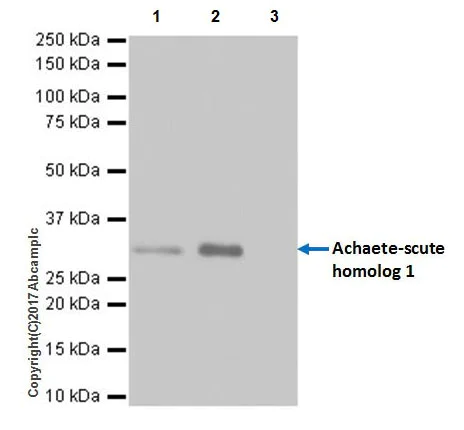 Immunoprecipitation - Anti-MASH1/Achaete-scute homolog 1 antibody [EPR19840] (AB211327)