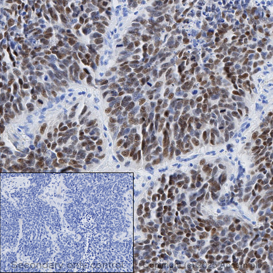 Immunohistochemistry (Formalin/PFA-fixed paraffin-embedded sections) - Anti-MASH1/Achaete-scute homolog 1 antibody [EPR19840] - BSA and Azide free (AB240385)