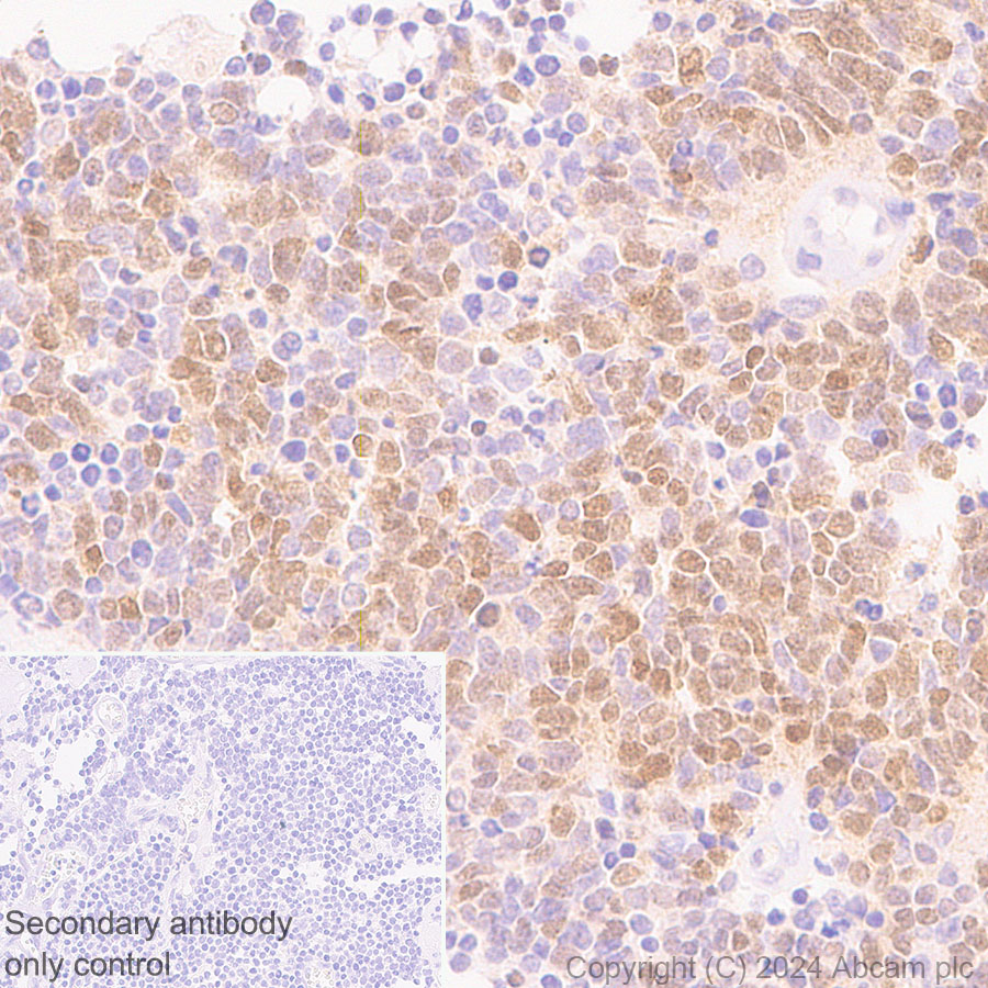 Immunohistochemistry (Formalin/PFA-fixed paraffin-embedded sections) - Anti-MASH1/Achaete-scute homolog 1 antibody [RM1182] (ab322665), expandable thumbnail