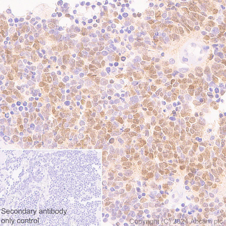 Immunohistochemistry (Formalin/PFA-fixed paraffin-embedded sections) - Anti-MASH1/Achaete-scute homolog 1 antibody [RM1182] (AB322665)