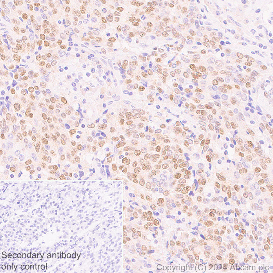 Immunohistochemistry (Formalin/PFA-fixed paraffin-embedded sections) - Anti-MASH1/Achaete-scute homolog 1 antibody [RM1182] (ab322665), expandable thumbnail