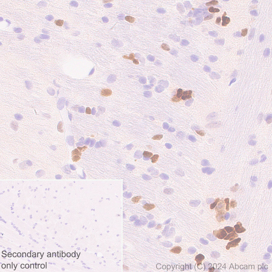 Immunohistochemistry (Formalin/PFA-fixed paraffin-embedded sections) - Anti-MASH1/Achaete-scute homolog 1 antibody [RM1182] (ab322665), expandable thumbnail