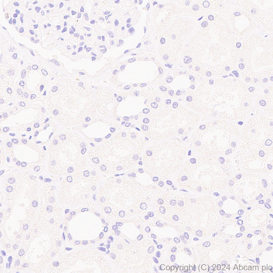 Immunohistochemistry (Formalin/PFA-fixed paraffin-embedded sections) - Anti-MASH1/Achaete-scute homolog 1 antibody [RM1182] (AB322665), expandable thumbnail