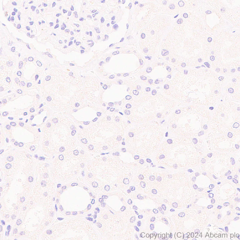 Immunohistochemistry (Formalin/PFA-fixed paraffin-embedded sections) - Anti-MASH1/Achaete-scute homolog 1 antibody [RM1182] (AB322665)