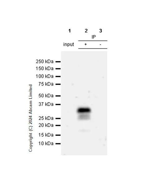 Immunoprecipitation - Anti-MASH1/Achaete-scute homolog 1 antibody [RM1182] (AB322665)