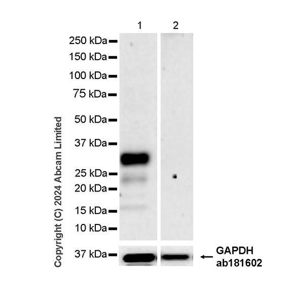 Western blot - Anti-MASH1/Achaete-scute homolog 1 antibody [RM1182] (ab322665), expandable thumbnail