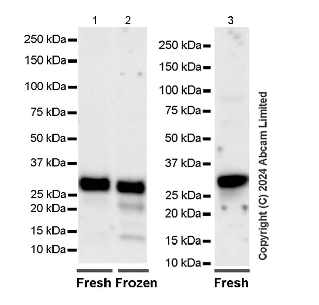 Western blot - Anti-MASH1/Achaete-scute homolog 1 antibody [RM1182] (AB322665)