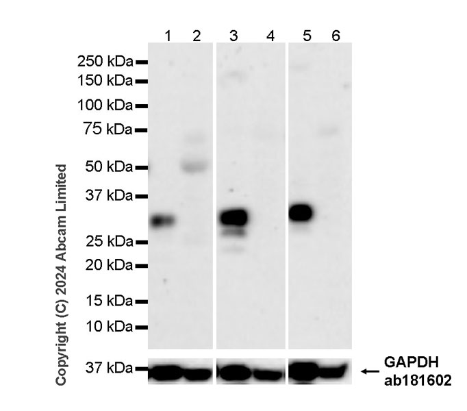 Western blot - Anti-MASH1/Achaete-scute homolog 1 antibody [RM1182] (ab322665), expandable thumbnail