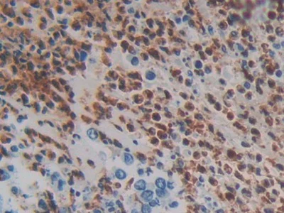 Immunohistochemistry (Formalin/PFA-fixed paraffin-embedded sections) - Anti-MASP1 antibody (AB232945)
