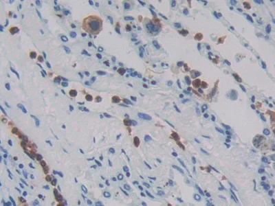 Immunohistochemistry (Formalin/PFA-fixed paraffin-embedded sections) - Anti-MASP1 antibody (AB232945)