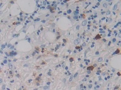 Immunohistochemistry (Formalin/PFA-fixed paraffin-embedded sections) - Anti-MASP1 antibody (AB232945)