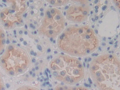 Immunohistochemistry (Formalin/PFA-fixed paraffin-embedded sections) - Anti-MASP1 antibody (AB232945)