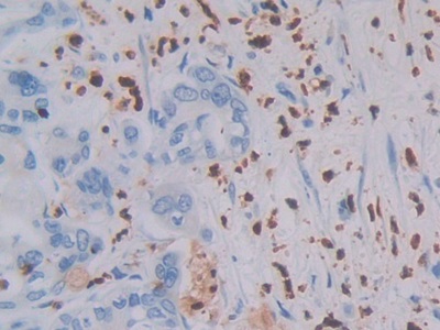 Immunohistochemistry (Formalin/PFA-fixed paraffin-embedded sections) - Anti-MASP1 antibody (AB232945)