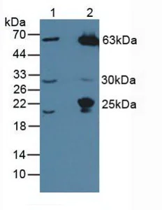 Western blot - Anti-MASP1 antibody (AB232945)