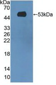 Western blot - Anti-MASP1 antibody (AB232945)