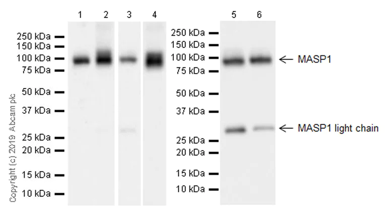 Western blot - Anti-MASP1 antibody [EPR22680-36] (AB255814)