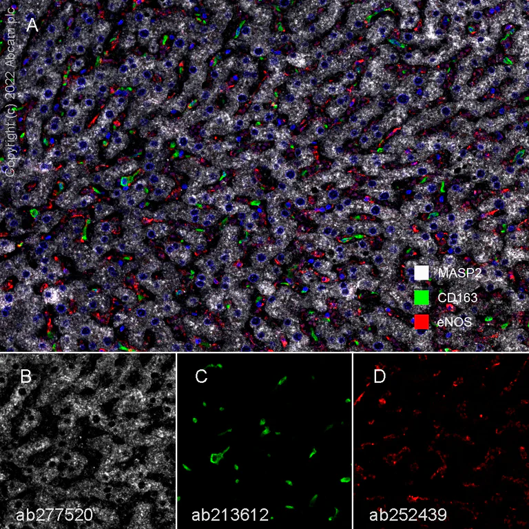 Multiplex immunohistochemistry - Anti-MASP2 antibody [EPR23588-44] (AB277520)