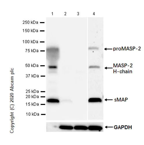 Western blot - Anti-MASP2 antibody [EPR23588-44] - BSA and Azide free (AB277528)